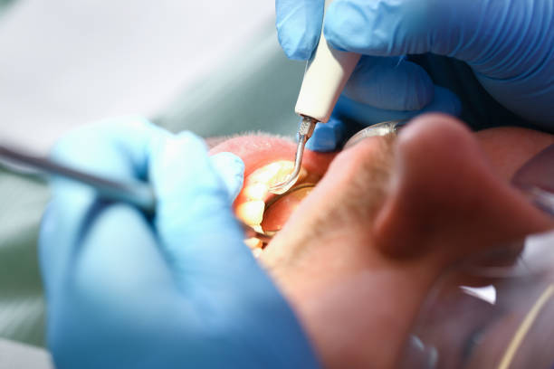 Best Affordable Emergency Dental Care  in Broadlands, VA
